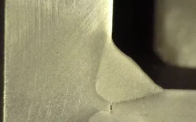 Ciemna strona pachwiny