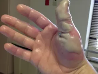 Instalacja do&nbsp;produkcji kwasu HF&nbsp;– BHP